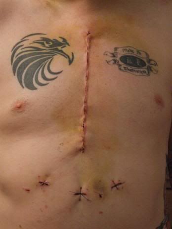 scar.jpg
