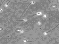 sperm