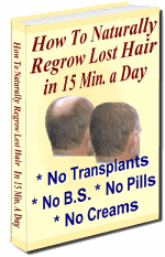 END HAIR LOSS NOW